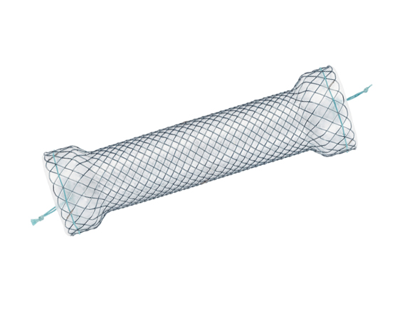 Niti-S Esophageal  Covered Stent